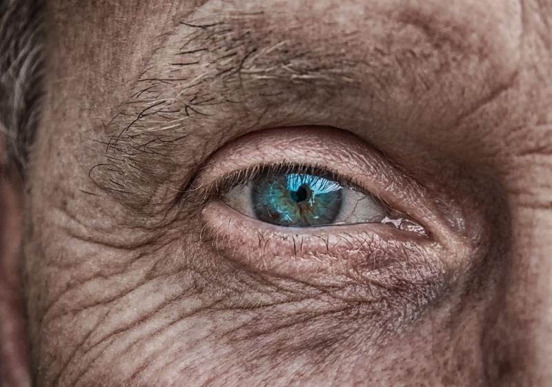 Hautalterung schon ab 25 Jahren - kann lästigen Falten im Gesicht vorgebeugt werden?